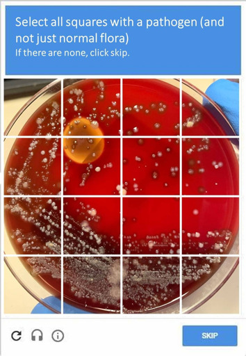 A CAPTCHA image shows a petri dish divided into 16 squares, with the prompt "Select all squares with a pathogen (and not just normal flora). If there are none, click skip." The petri dish contains a red growth medium with several distinct types of bacterial colonies. Some colonies are small, white, and circular, while others appear larger, irregularly shaped, and have a more grayish or fuzzy texture. In the center, there is a large yellow-orange blob. The bottom of the image shows three icons for refresh, audio, and information, along with a "SKIP" button.